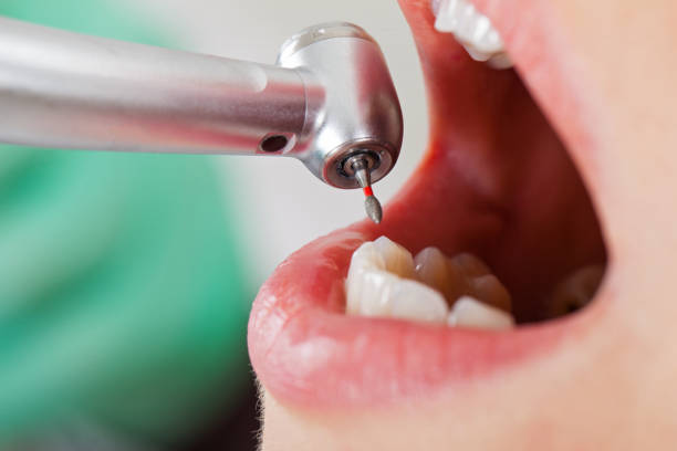 Best Emergency Dental Surgery in Dunlap, IN